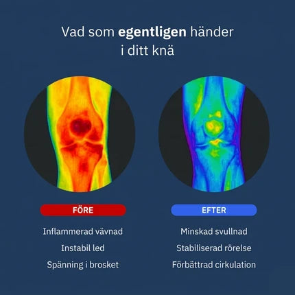 Avancerat knäskydd mot artros